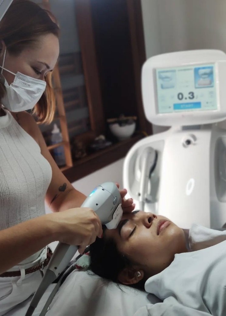 Ultraformer Treatment